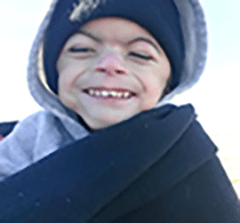 Child with CdLS wearing a hoodie and smiling at the camera