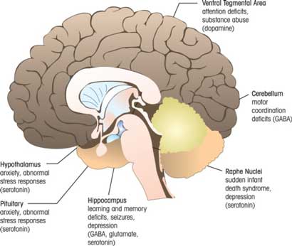 Regions of the Brain that can be Affected in FASD